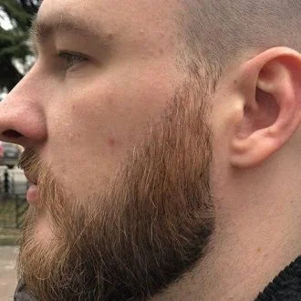 Full beard after 60 days with BeardForge