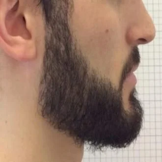 Thick beard after BeardForge routine