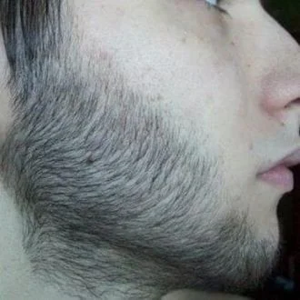 Full beard transformation result